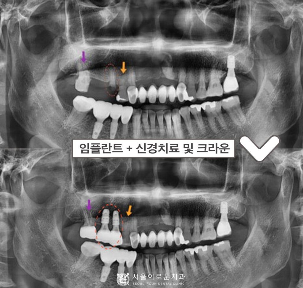 부천시청역치과