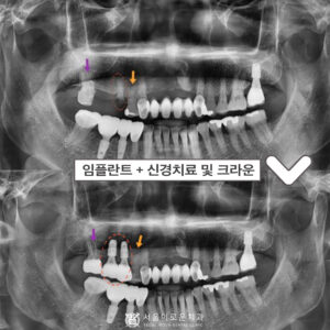 부천시청역치과