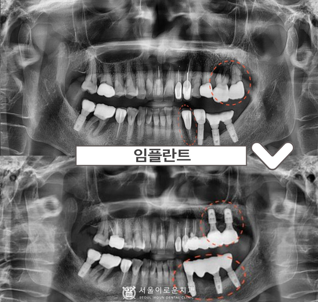 서울이로운치과