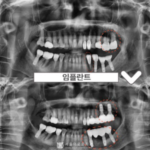 서울이로운치과