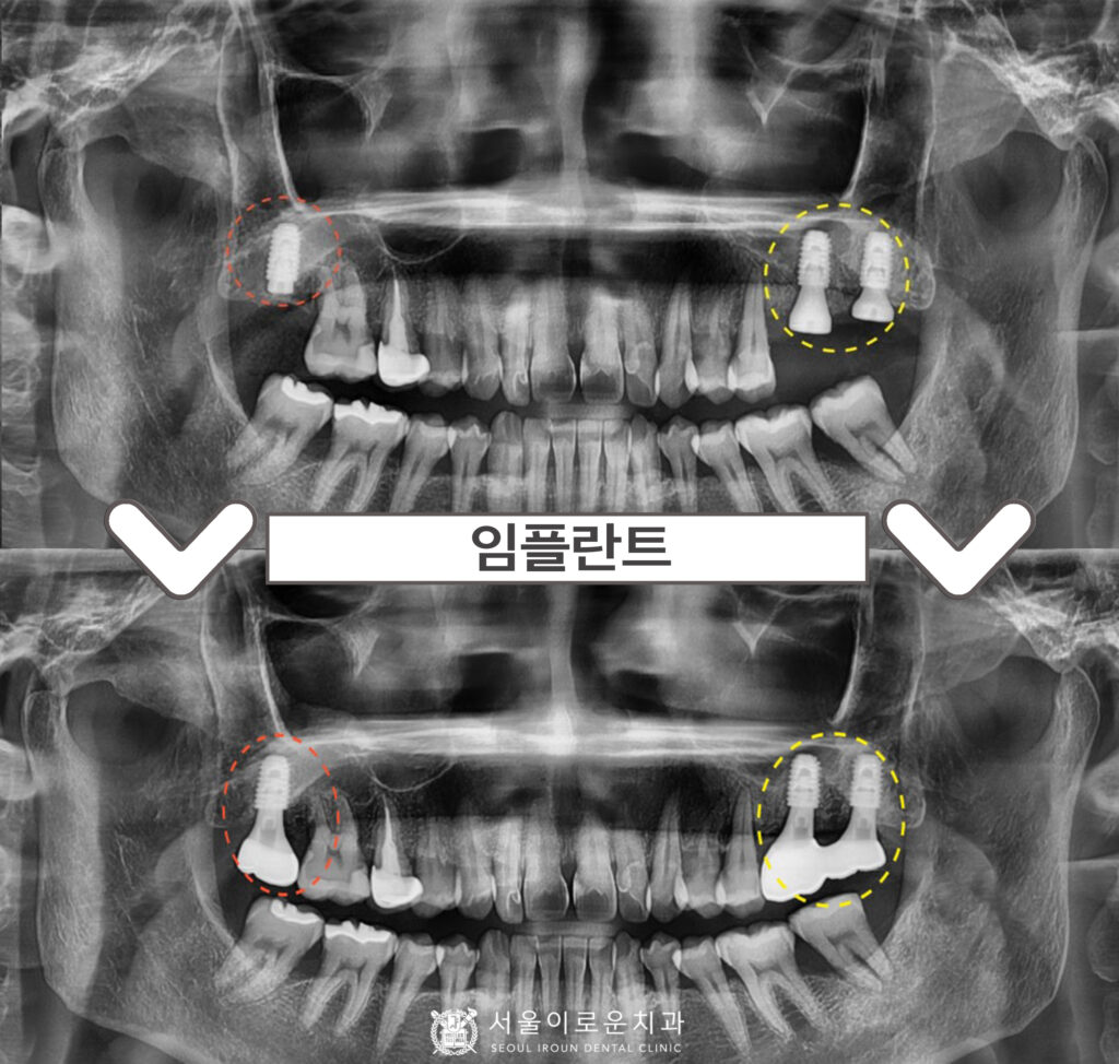 부천시청역치과