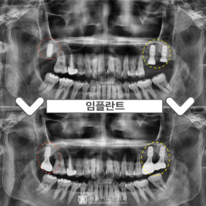 부천시청역치과