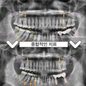 부천서울이로운치과