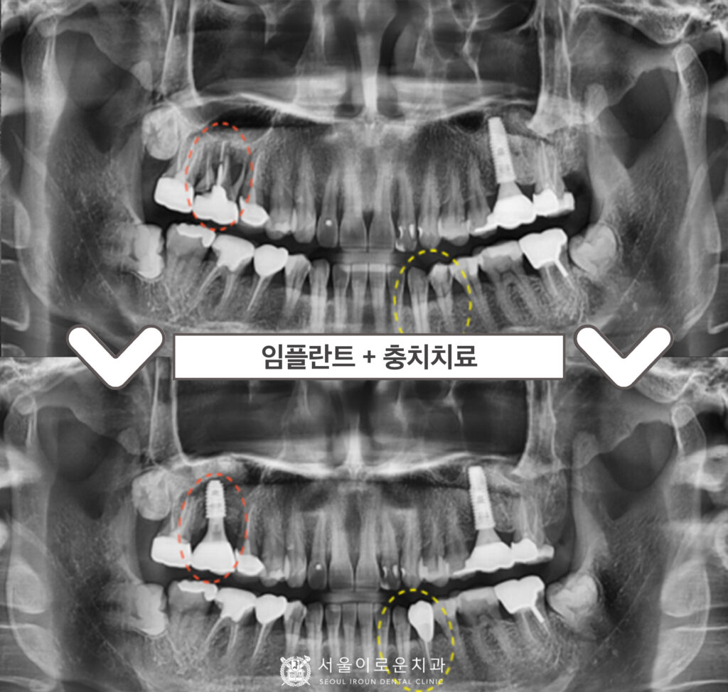 서울이로운치과