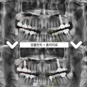 서울이로운치과