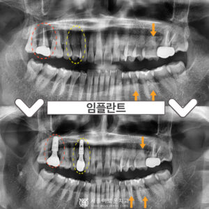 0썸넬