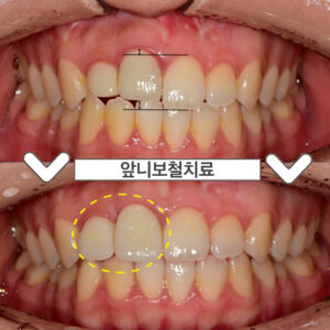 ㅇㅇㅇ
