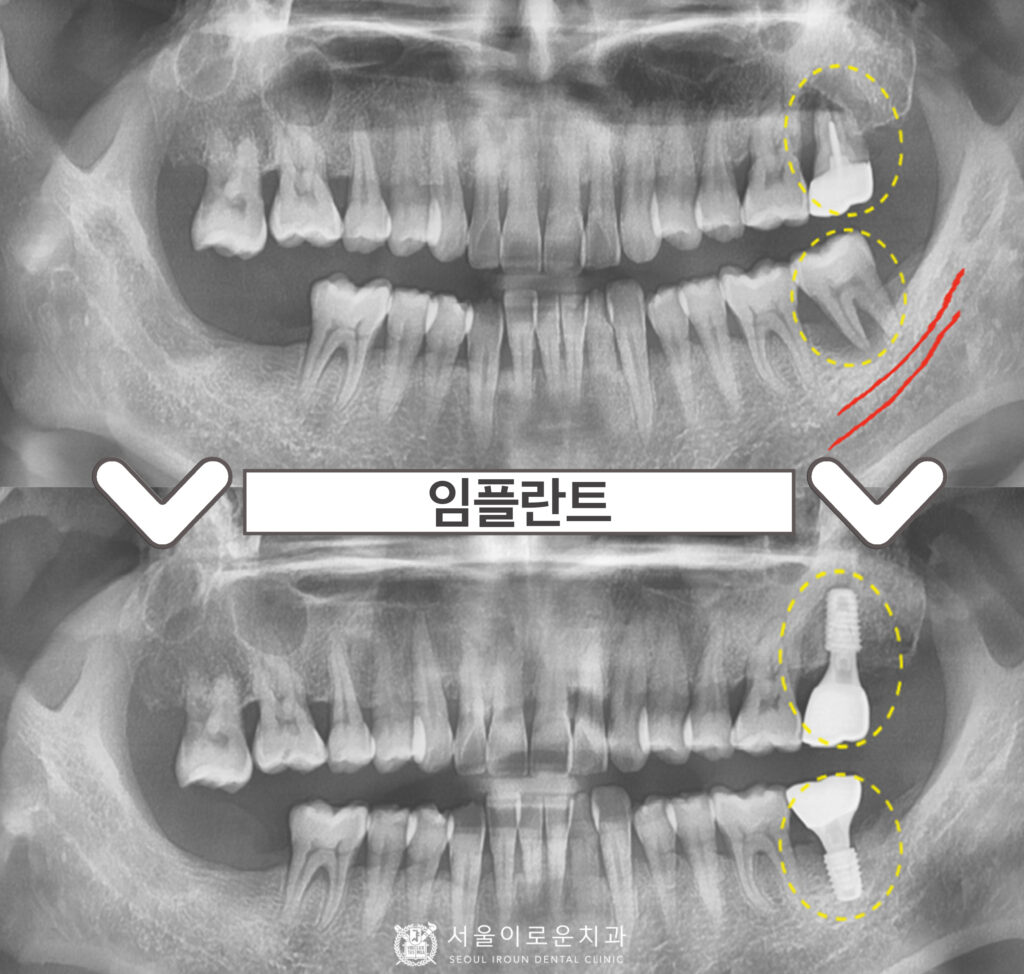서울이로운치과
