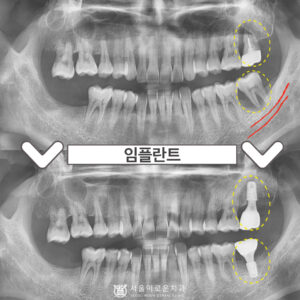 0.썸네일