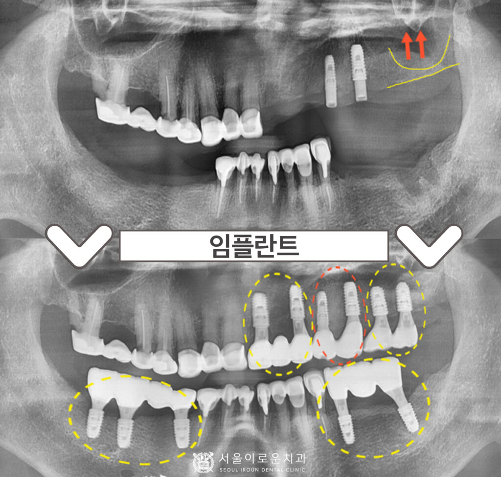부천시청역치과