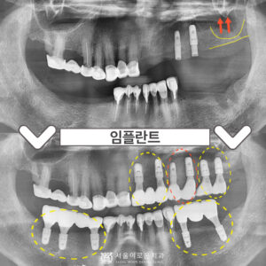 0.썸네일