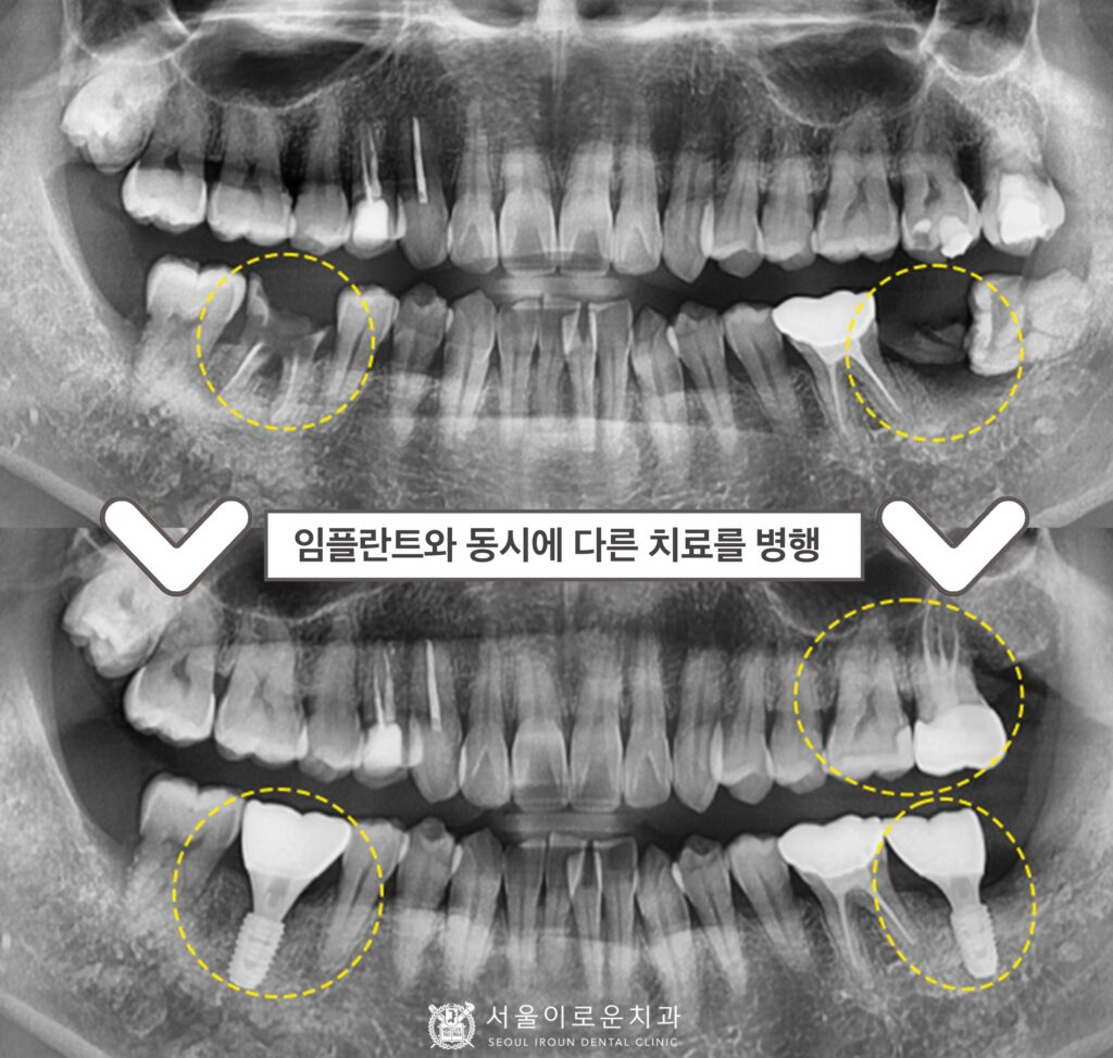 부천서울이로운치과
