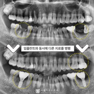 부천서울이로운치과0.썸네일