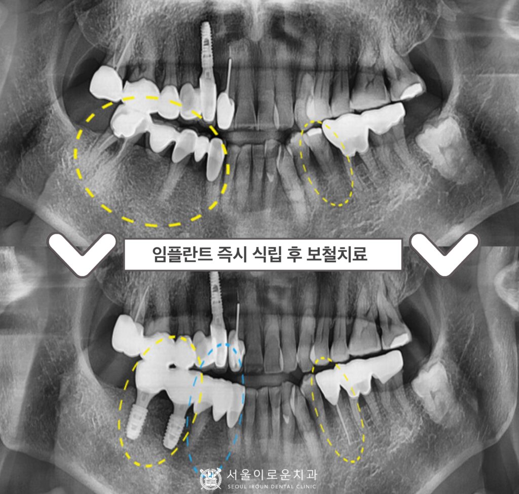 부천시청역치과