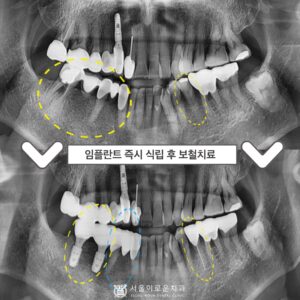 부천시청역치과0