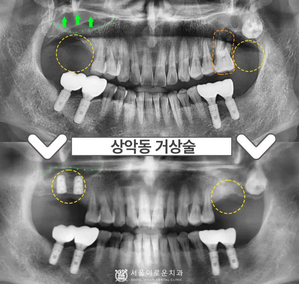 부천시청역치과