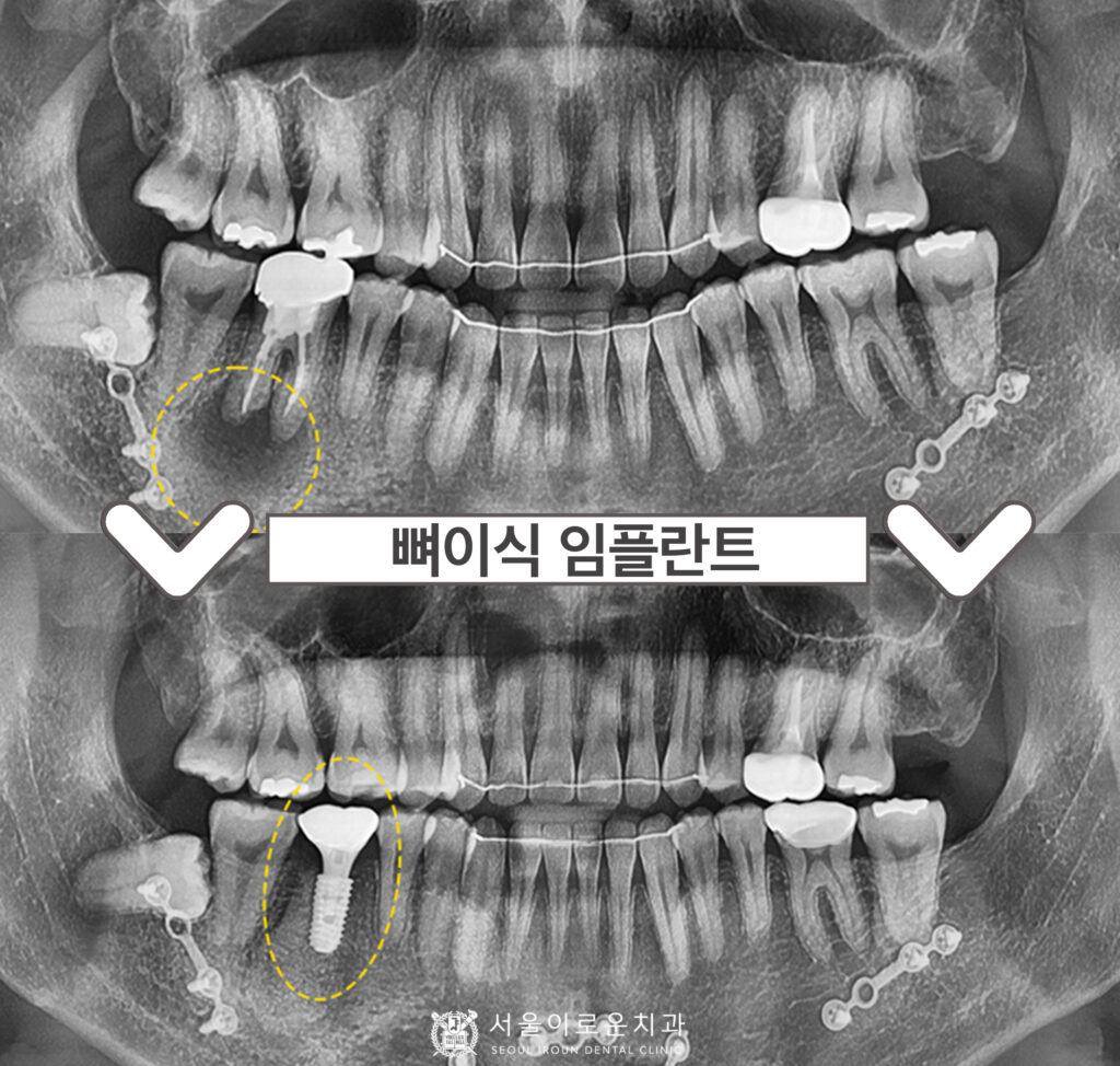 부천시청역치과