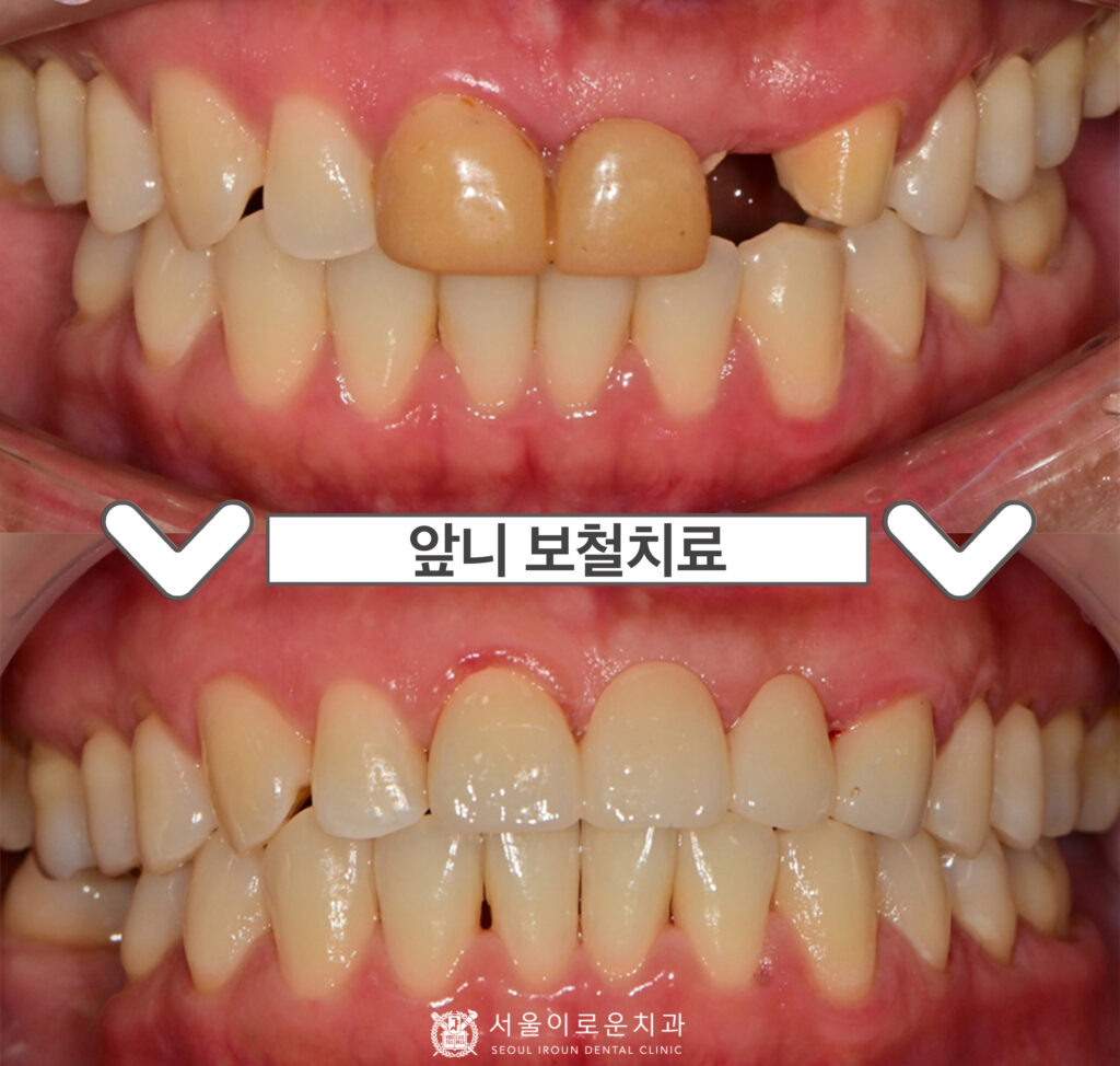 서울이로운치과