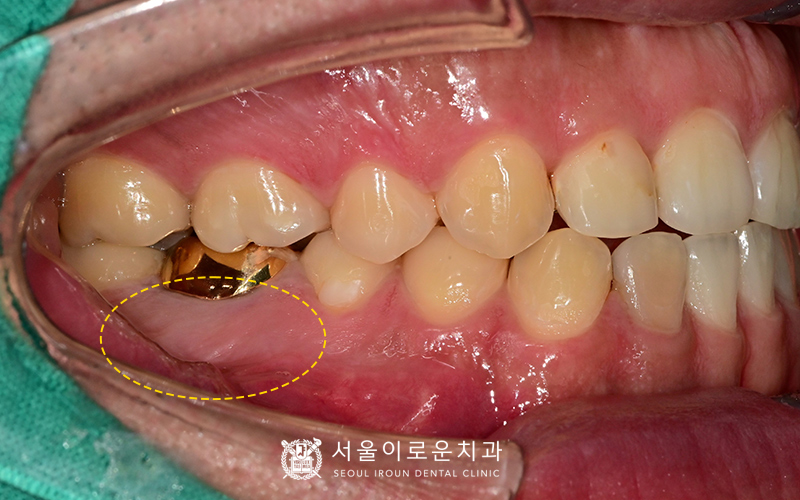 부천시청역치과