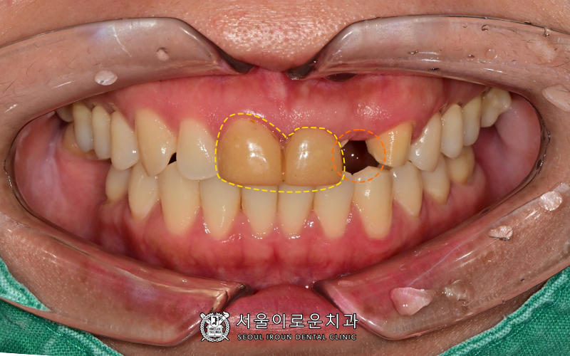 서울이로운치과