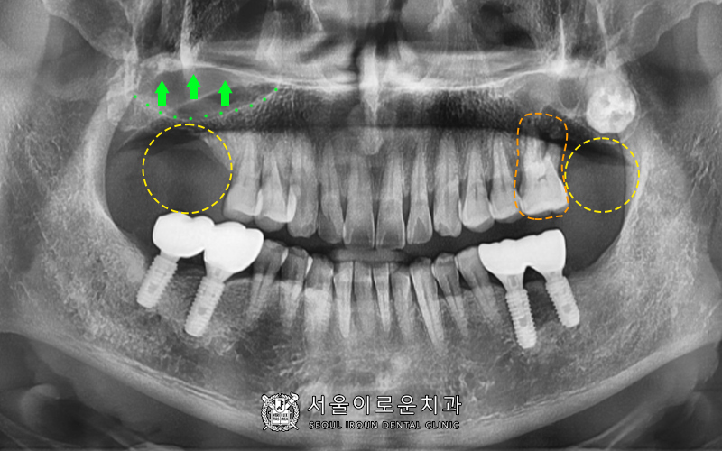 부천시청역치과