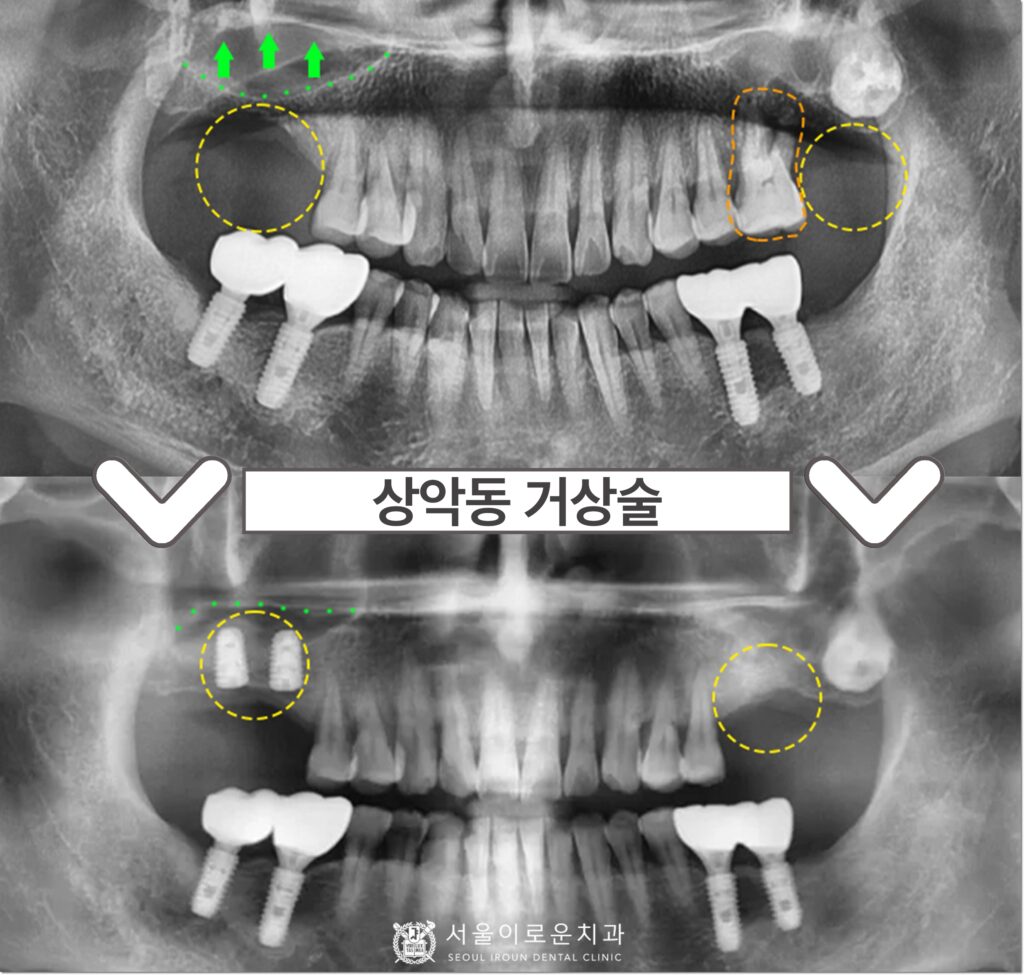부천서울이로운치과