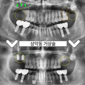 부천서울이로운치과0.썸네일