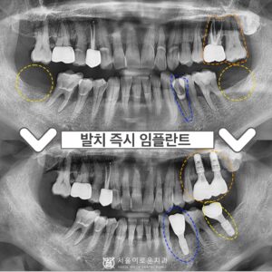 부천시청역치과0.썸네일