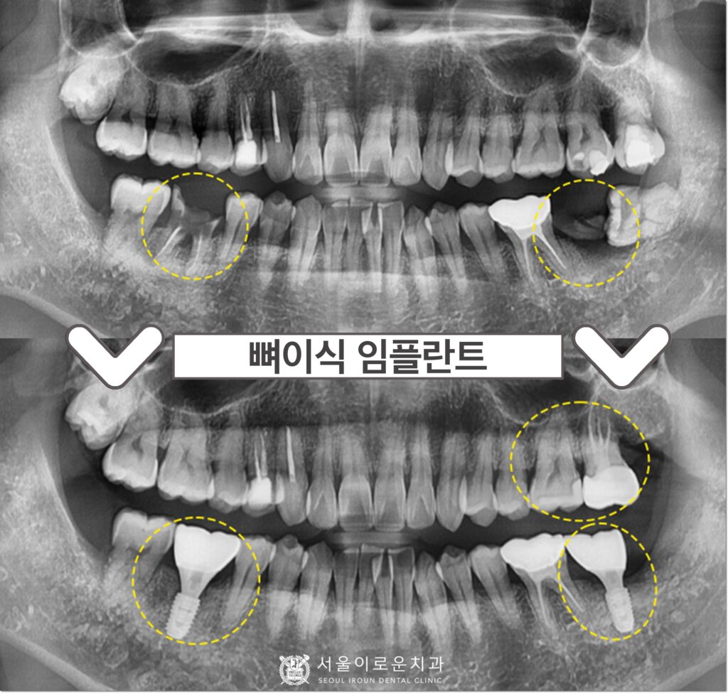 부천시청역치과