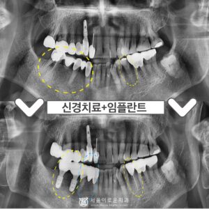 부천중동치과0.썸네일