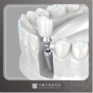 부천시청역치과