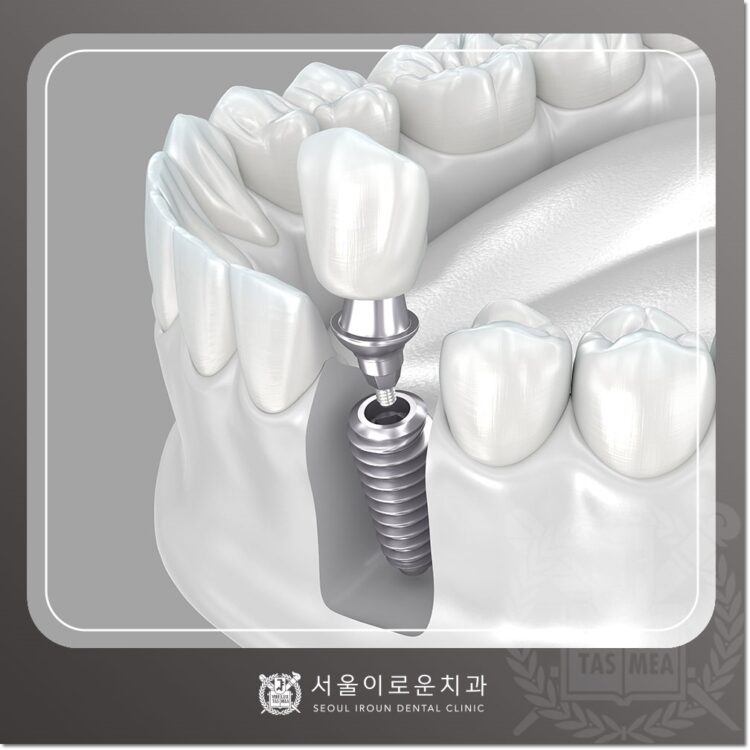 부천시청역치과