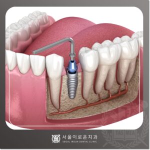 서울이로운치과