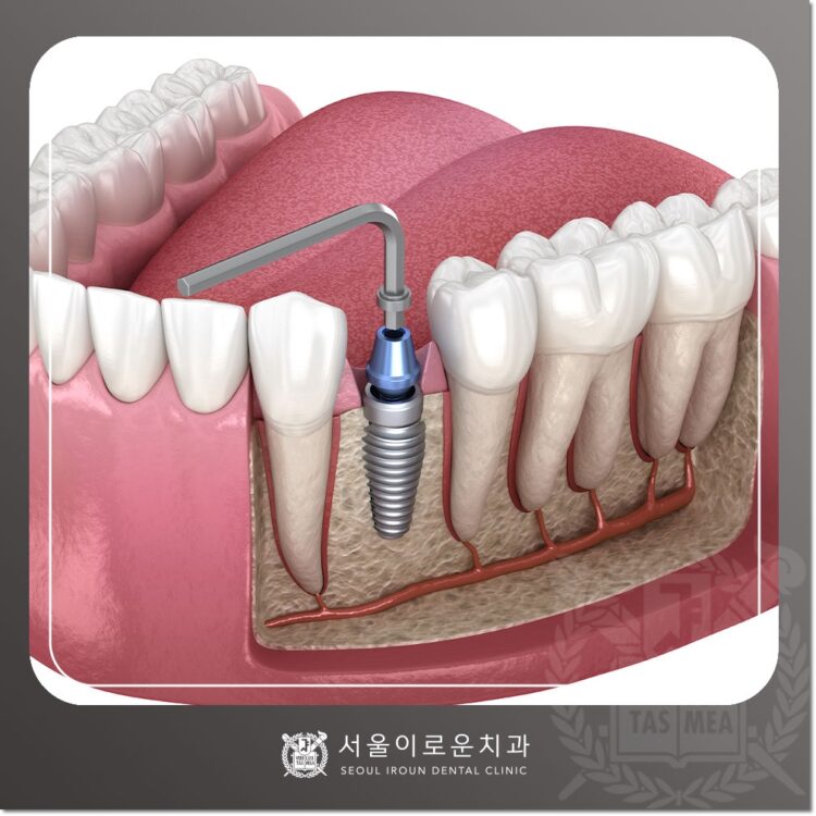 서울이로운치과